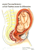 20-col-uterus