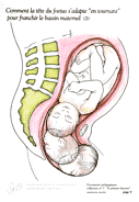 09-tete-adaptation-3