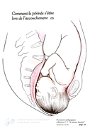 16-perinee-accouchement