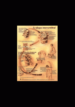 Poster plastifié N° 3 : Le disque intervertébral