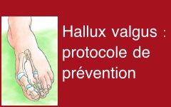 halluxvalgus.3jpg.jpg