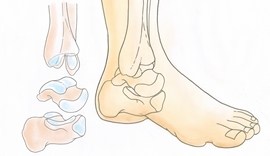 Cheville_pied_et_Yoga